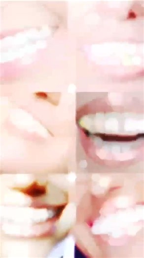 ✨ Crooked Teeth? Hiding Your Smile in Photos?? If you’re tired of feeling insecure about your teeth, braces might be the life-changing solution you need! 😍 . Let’s create your best smile together! 🔸 Hospital-level safety & care 🔸 Gentle, effective alignment 🔸 Boosts confidence day by day Braces done with modern, comfortable orthodontic techniques 🦷✨ 📲 Book through the Carehaejo App 🧑‍💼 Use Manager’s Code: TL24002 📞 010-6692-3469 #BracesJourney #PerfectSmile #SmileGlowUp #DentalBraces #C