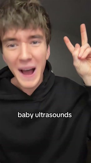 why do we glaze these bro #fyp #foryoupage #viral #trend #trending #shorts