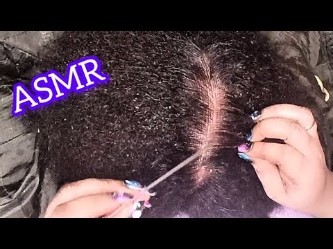 ASMR Dandruff Removal 💆‍♀️ Long Nails & Comb | Deep Scalp Care & Sleep Aid