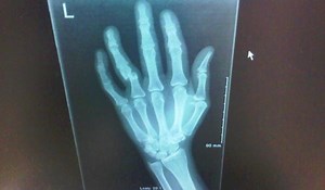 Dog Bite and Dog Attack Photos