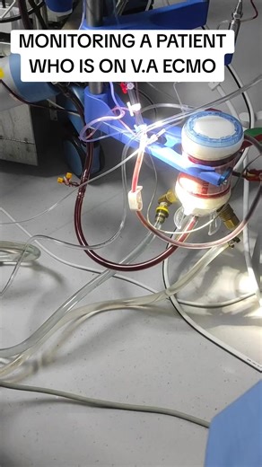 Monitoring a patient on VA ECMO