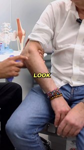 37K views · 60 reactions | Tennis elbow occurs when repetitive motions, like swinging a racket or typing, strain the tendons near the elbow, causing pain and inflammation. Steroid injections are a focused treatment option that can reduce inflammation and support healing, especially when other treatments haven’t worked. #elbowpain #painmanagement | Precision Care Medical & Sports Performance | Facebook