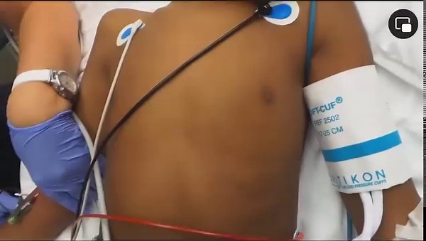 Educational purposes only. Kussmaul Breathing Pattern | Paramedics on Facebook