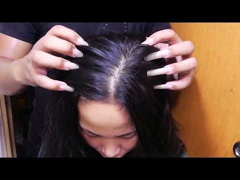Fast & Aggressive ASMR Scratch Itchy Scalp, So I Did! Satisfying Scalp Scratching - No Talking