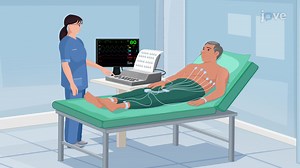 Video: Electrocardiogram