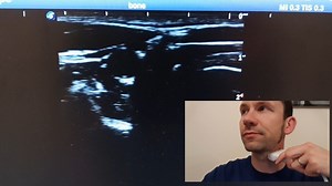 8. Blood Vessel Part 1 - Probe Posn & Inflate Jugs