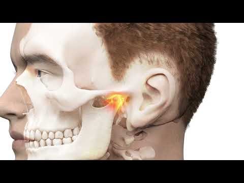 TMJ Disorders Explained – Jaw Pain, Clicking & Treatment Options
