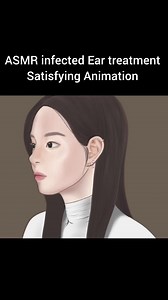 ASMR ear treatment satisfying animation #asmr #treatment #animation #fyp #unfreezemyacount