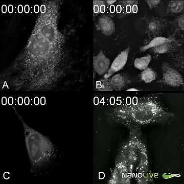Label-free live cell imaging of different cell death types