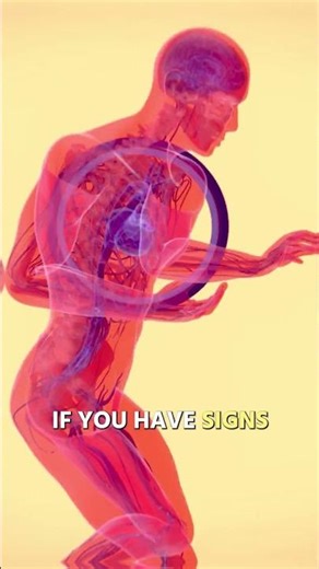 Watch For THIS With Heart Attack Victims