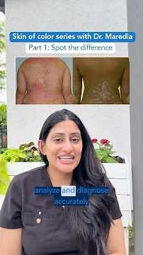 These skin conditions look different based on skin tone #skinofcolor #dermatologistadvice