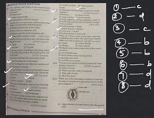 Liquid which collects in the cavity of Bowman's capsule is  :... | Filo