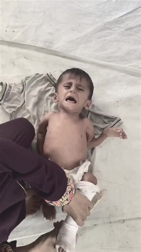 If you believe in humanity kindly don't scroll donate anything via the PayPal link in bio to save my child #gaza #fyppp #Help #gazaunderattack #tiktokbabies