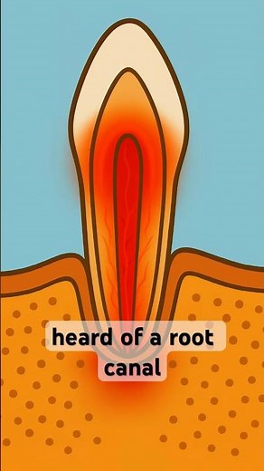 Root Canal Treatment Explained