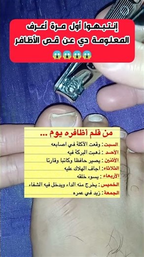 معلومة عجيبة عن مقص الأظافر أول مرة اعرفها.. 😳💅❌