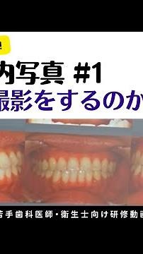 口腔内写真#1「撮影の重要性と写真の良い・悪いの見分け方」