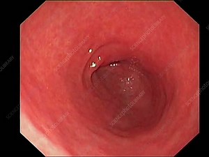 Peristalsis in the stomach, endoscopy - Stock Video Clip - K002/8763