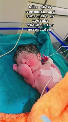 “Under observation doesn’t mean danger ❌It means extra care ❤️” #neonatalcare #neonataltherapy