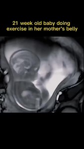 6.3M views · 29K reactions | Do you feel fetal movement when you are pregnant So cute殺 | Parenting Mangi | Facebook