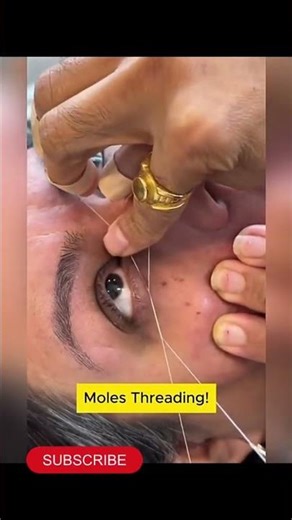 Mole Threading – So Satisfying 😌 Relax your mind ✨Pure satisfying moment #skincare#trendingreels