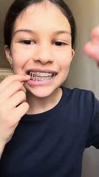 How to Use Dental Wax for Braces!