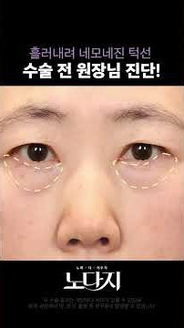 50대 안면거상, 성형외과 전문의의 수술 전 진단은?