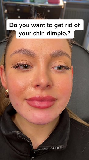 Chin Dimple Removal: All You Need to Know