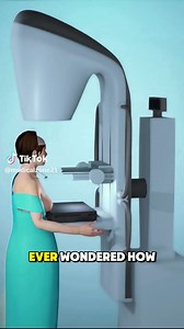 2.5K views · 17 reactions | Mammography Technique | The Art Of Medical | Facebook