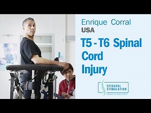 Enrique T5-T6 Spinal Cord Injury Patient from USA Undergoes Epidural Stimulation Surgery