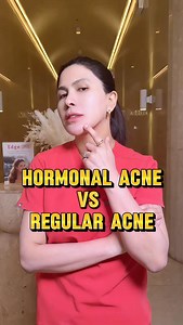 Acne is something a lot of people deal with, especially during the teen years. But not all acne is the same. Today, we’re breaking down the difference between hormonal acne and regular acne, and how to tell them apart. #AuraRuz #AuraRuzAesthetics #Acne #HormonalAcne #RegularAcne | The Aura Ruz Timog Branch
