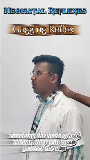 Neonatal Reflexes. #trending #viralvideo #shorts #ytshorts #neonate #reflexes