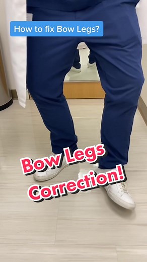 Understanding Bowlegs: Causes, Correction, and More!