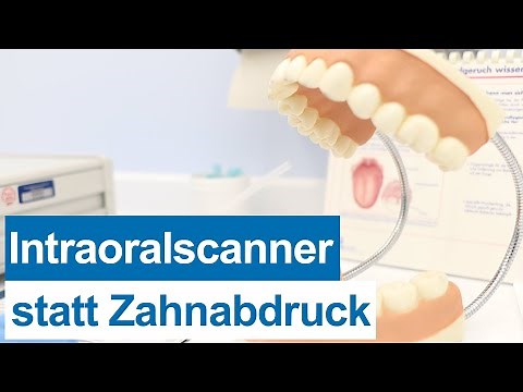 Intraoralscanner in der Zahn-, Mund- und Kieferheilkunde