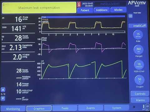 How to Detect Air Leak on the Ventilator and What is Maximum Compensation Alarm