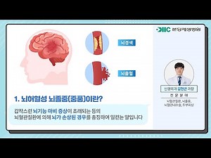 뇌혈관질환의 신경외과적 치료법