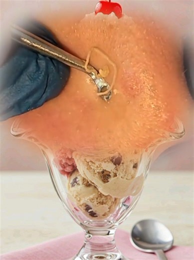 Effective Blackhead Removal Techniques