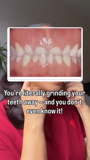 Bruxism — teeth grinding, jaw clenching, all that built-up tension. I see it all the time in my clients. The damage is real — and if it’s left untreated, it can lead to painful symptoms and expensive dental bills. That’s why treatments to release that tension are so important — and it’s exactly what I offer. But it doesn’t stop there. One of the reasons I created my app was because so many people come in for treatments, then don’t know what to do in between. Inside the app, I guide you through s