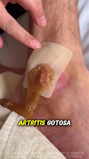 Can’t stand the joint pain anymore? Use the right method, and you can relieve the pain in just three days！knee pain Savior！#Painreliefpatch #musclepain#DrMitsui#heatapplicationtorelievepain#DRMITSUIpainreliefpatch-PH