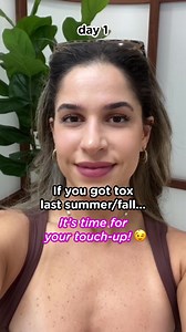 𝗦𝗺𝗼𝗼𝘁𝗵, 𝗦𝗻𝗮𝘁𝗰𝗵𝗲𝗱, & 𝗙𝗹𝗮𝘄𝗹𝗲𝘀𝘀! 💖✨ It’s been a while since we’ve seen you—let’s refresh that glow! 💕 Say goodbye to fine lines and hello to a more youthful look. For a limited time, get 20 units of Botox for just $199! 😍 Use code TOX-DEAL at checkout to claim your offer! ✨ Soft, natural, and expertly done—because less is more when it comes to looking effortlessly fresh! | BeautyFix Med Spa