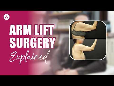 Arm Lift in Turkey: Awake Arm Lift, Local Anesthesia & Twilight Sedation #armlift #akmclinic
