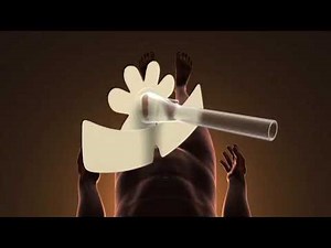 Bioderm Men's Liberty Classic Male External Catheter