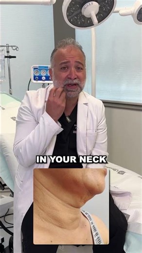 RF Microneedling VS. Facelift?