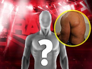 WATCH: Former champion reveals gruesome battle scars after brutal Street Fight match on Raw