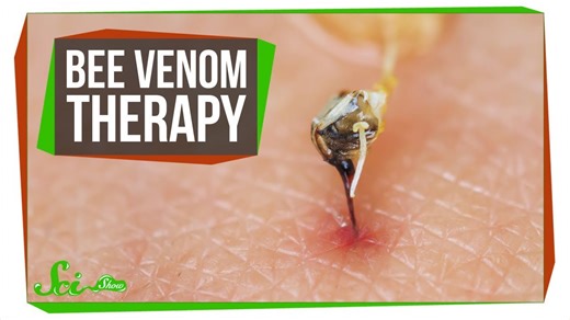 The problem with bee venom therapy