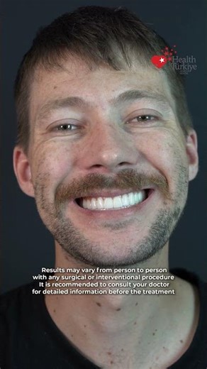 Full Mouth Transformation | Extractions, Implants & Zirconium Crowns