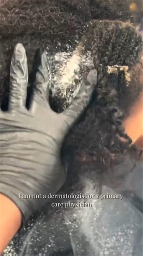 deep scalp detox: from dry flakes to clean & moisturized 🧼💆🏾‍♀️#scalpcare