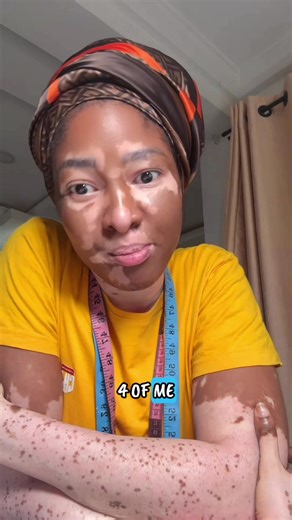 Understanding Healing in Vitiligo: A Personal Journey