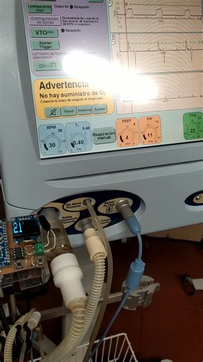 Monitor Fio2 con arduino. Prototipo para celdas distinta marca con Arduino Nano, mini display Oled y algunos componentes más. A quien le interese el tema, le envío más info. | Esteban Cabrera