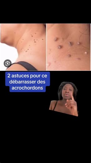 #fyp#conseil#naturopathe#mum🤰🏻debb👶miracle🙏mondieu❤️