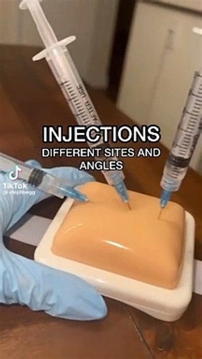 Intradermal,Dermal & Subcutaneous injection -An Overview